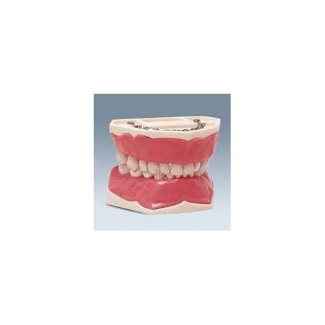 Frasaco Modelo AK6 (pediátrico)