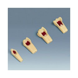 Dente Pulpoctomia marca Frasaco nº55