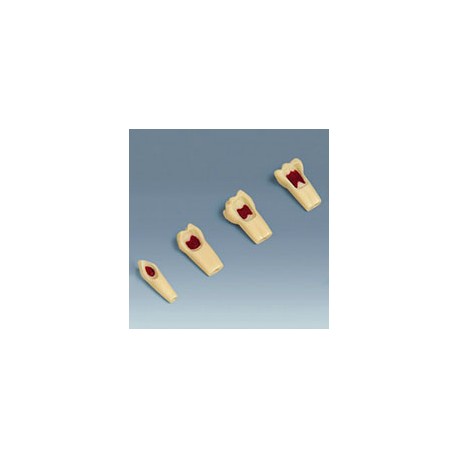 Dente Pulpoctomia marca Frasaco nº55